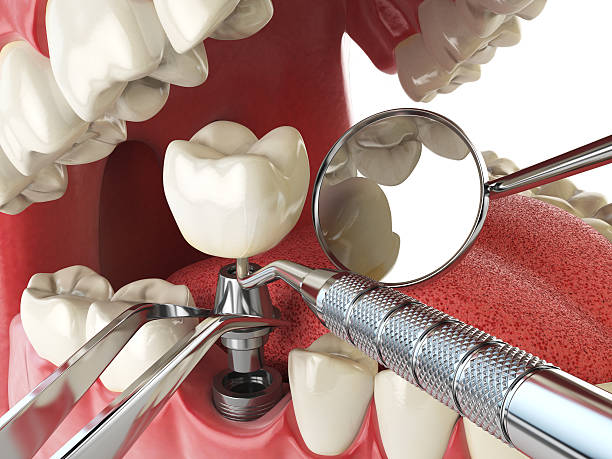 Best After-Hours Emergency Dentist in Bangor Base, WA