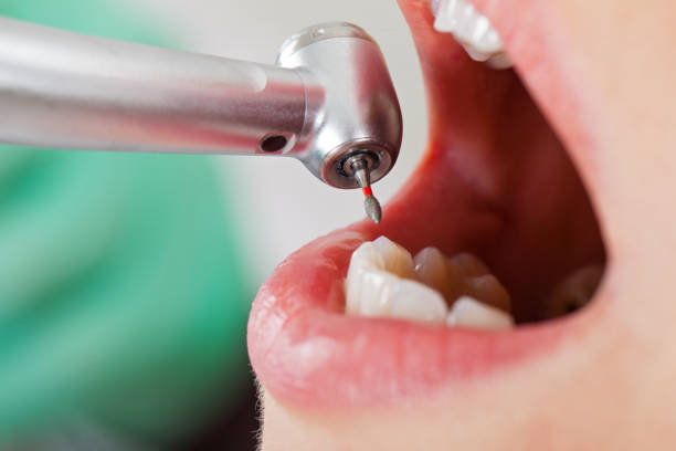 Best Emergency Orthodontic Repairs in Bangor Base, WA
